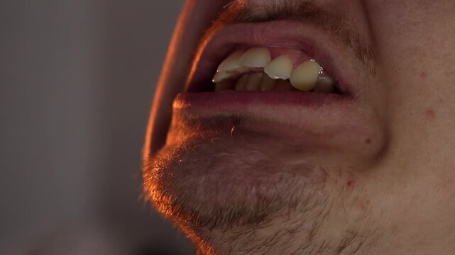 Protruding teeth in a man.
Malocclusion, large jaw