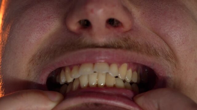 Uneven jaw bite.
Dental problems.
A man shows his jaw, clenches it, and demonstrates a deviation and problem with his teeth.