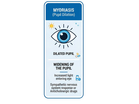 Mydriasis infographic illustrates the pupillary dilation process where the eye reacts to sympathetic nervous system activation or specific anticholinergic pharmaceutical drugs.
