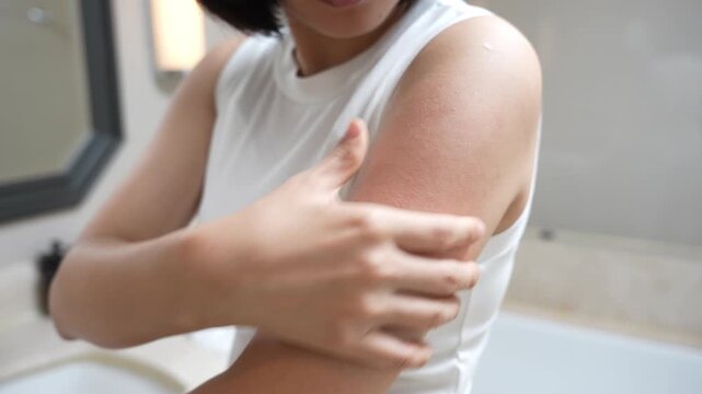skin problem and beauty. Young woman scratch body has itchy skin from skin allergic, steroid allergy, sensitive skin, red from sunburn, chemical allergy, rash, insect bites, Seborrheic Dermatitis.