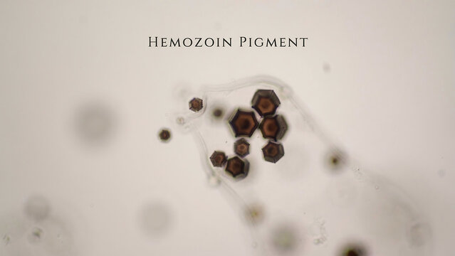 Closeup view of hemozoin pigment crystals under microscope in light brown color on white surface