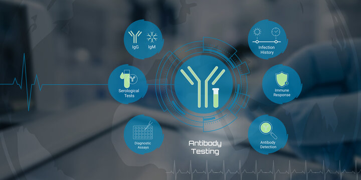 Modern antibody testing infographic showing serological tests immune response detection and diagnostic assays for medical research