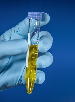 Rubber gloved hand hold measured tube with sample