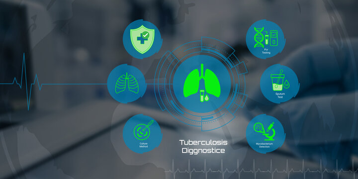 Modern tuberculosis diagnostic methods featuring lungs and medical testing icons connected by network lines