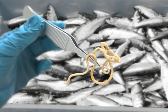 Doctor wearing gloves holding tweezers with Anisakis. Background with fish infected with Anisakis