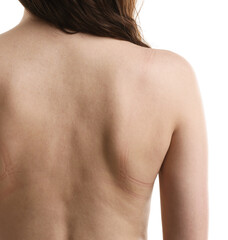 Naklejka premium Woman with bra marks on her skin against white background, closeup