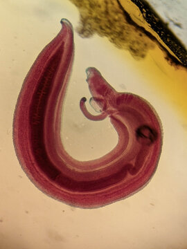Schistosoma haematobium Paired Male and Female Worms Coiled Showing Gynecophoral Canal Mi