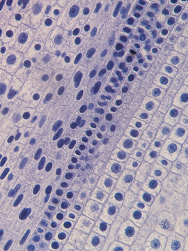 Allium cepa Root Tip Cells Showing Chromosomes During Telophase Stage of Mito