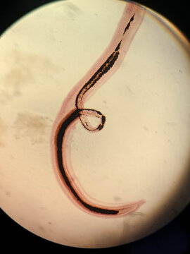 Schistosoma japonicum Male and Female Worms in Copula Showing Gynecophoral Canal Under Micr