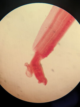 Schistosoma japonicum Paired Male and Female Worms in Copula Microscopy Prepar