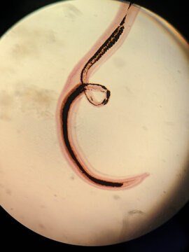 Schistosoma japonicum Male and Female Worms in Copula Showing Gynecophoral Canal Under Micr