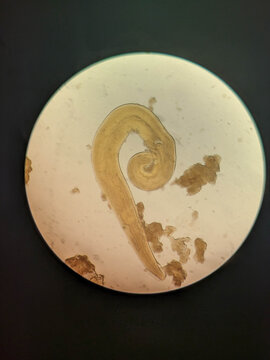 Enterobius vermicularis Adult Pinworm Showing Coiled Body and Tapered Tail Under Light Micr