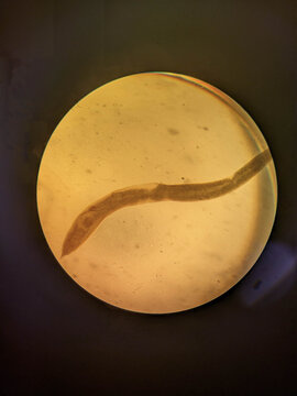 Enterobius vermicularis Adult Female Pinworm Showing Elongated Tapered Body Under Light Mic