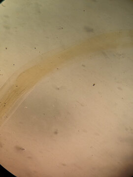 Ancylostoma duodenale Hookworm Posterior End Showing Curved Tail and Cuticular Structure Under Micro
