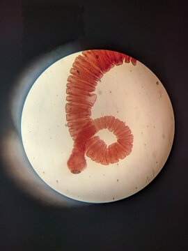 Taenia solium Gravid Proglottid Showing Uterine Branches and Terminal Segment Under Microsc