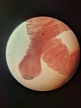 Taenia solium Gravid Proglottid Showing Uterine Branches and Terminal Segment Under Microsc