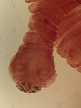 Taenia solium Gravid Proglottid Showing Uterine Branches and Terminal Segment Under Microsc