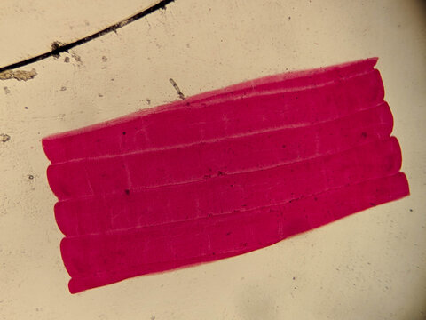 Taenia solium Immature Proglottids Showing Early Segmentation and Undeveloped Reproductive Organs Under