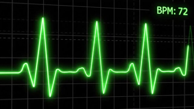 Second loop of heart monitor EKG with alpha c VSRExport showing heart rhythm data at 72 BPM
