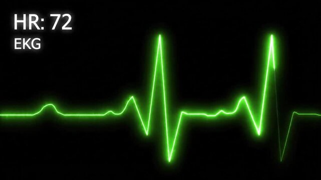 Second loop of heart monitor EKG with alpha b VSRExport showing heart rate at 72