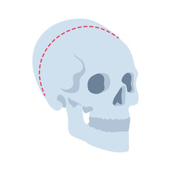Fototapeta premium Cranial Abnormalities Medical Anatomy Illustration