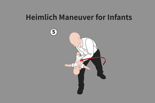 Heimlich Maneuver for Infants illustration 05