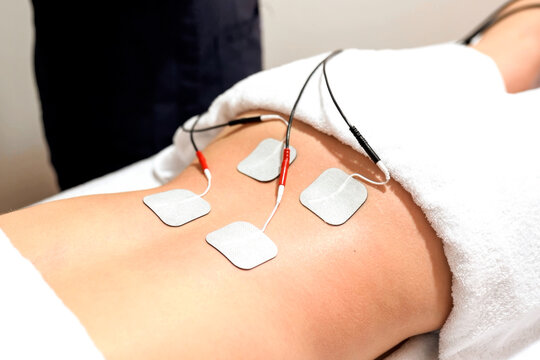 Electrotherapy pads applied to lower back during physiotherapy treatment