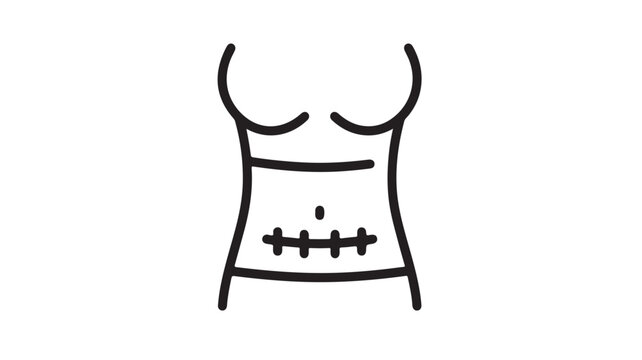 Minimalist surgical scar icon on female torso, medical cesarean section incision line vector, abdominal surgery recovery and postpartum healing illustration