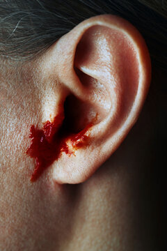 Close-up of a human ear bleeding from an injury