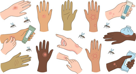 Fototapeta premium Insect Bite and Skin Rash Medical Vector Set with Mosquitoes Hand Swelling Inflammation Allergy Treatment Cream and Ice Pack Icons