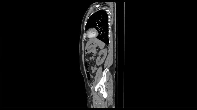 x-ray scan of side body by mri ct scan Internal Organs and Liver,Lungs,Intestines,Stomach,Bladder,Kidneys.	