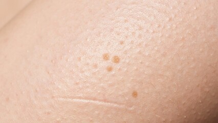 Fototapeta premium Close up of human skin with moles and freckles on surface