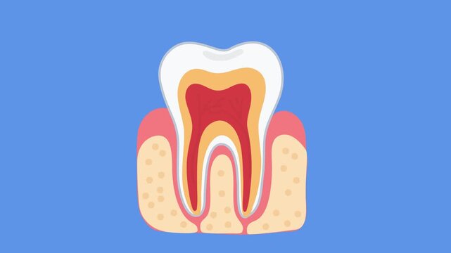 animation root canal inflammation inside human tooth