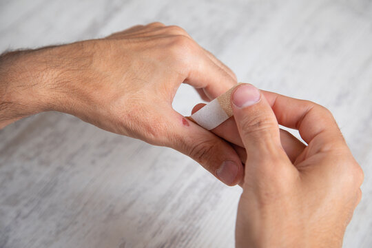 Caucasian man showing callus on hand.