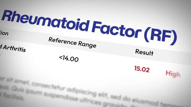 High level rheumatoid factor blood test analysis for rheumatoid arthritis diagnosis, 4k animation medical report illustration