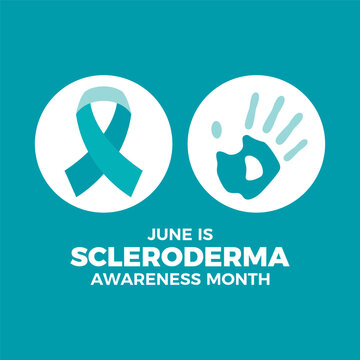 June is Scleroderma Awareness Month poster vector illustration. Teal awareness ribbon and handprint icon set vector. Chronic autoimmune connective tissue disease symbol. Template for banner, card