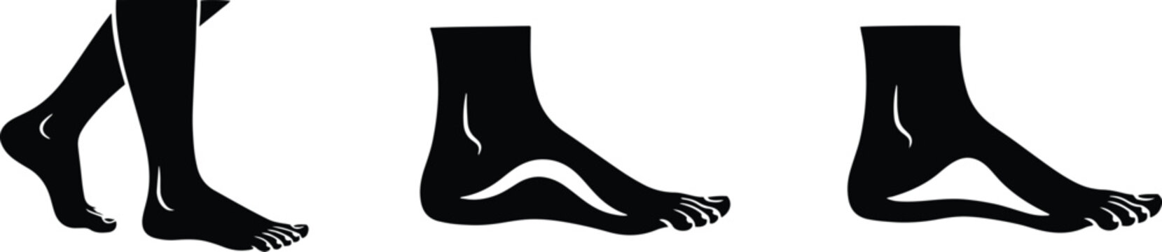 Human foot anatomy showing normal arch and flat feet condition pes planus medical silhouette vector illustration.