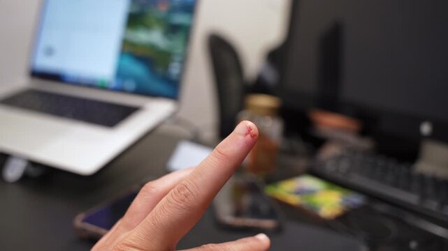 Close-up of a human hand showing a small bleeding cut on the index finger. The hand is held up against a blurred background of a modern home office desk with a laptop.