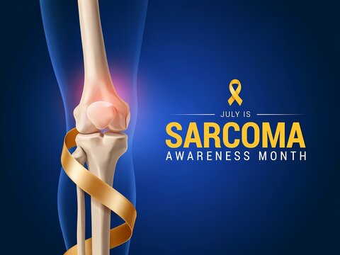 Sarcoma awareness month concept with human knee bone anatomy and yellow ribbon on blue background