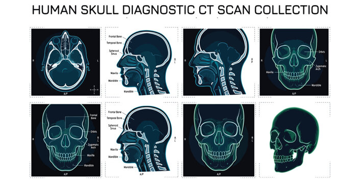 Human skull diagnostic ct scan collection showing anatomical bone structure for medical diagnostics.