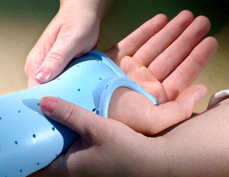 Hand in splint