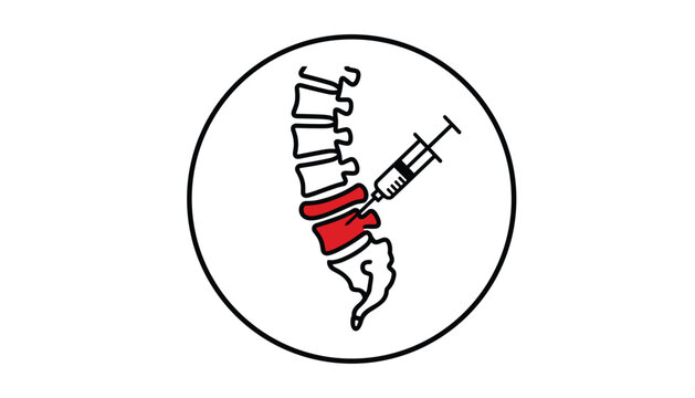 Medical diagram of a spine with lumbar disc herniation receiving a steroid or epidural injection from a syringe on white.