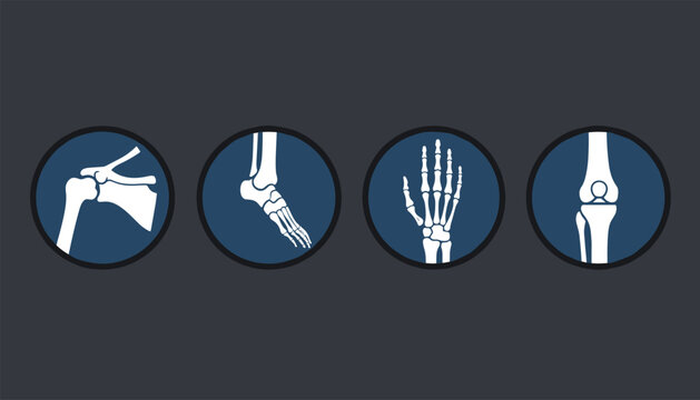 Skeletal joint icons depicting diagnostic x-ray views of shoulder, ankle, hand, and knee bone structures.