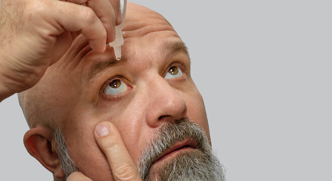 Man using eye drops to moisturize eyes. Dry eye syndrome, vision health, allergy relief.