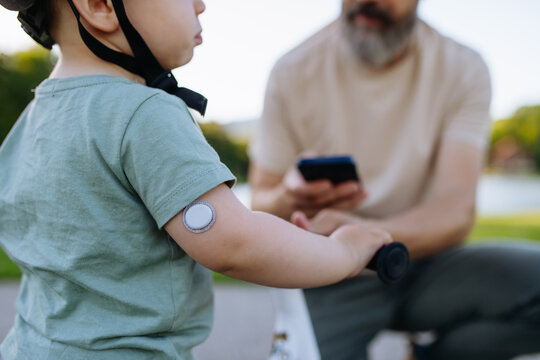 Father checking blood sugar level of little son, using cgm sensor and mobile app.