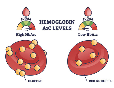 Hemoglobin A1c levels visual compares high vs low glucose binding on red blood cells, red blood cell, glucose dots, and sugar gauge convey diabetes monitoring concept, transparent background.