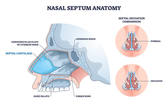 Nasal septum anatomy illustrated, side view shows septal cartilage, vomer bone, and ethmoid plate with normal vs deviated comparison for airflow clarity, transparent background