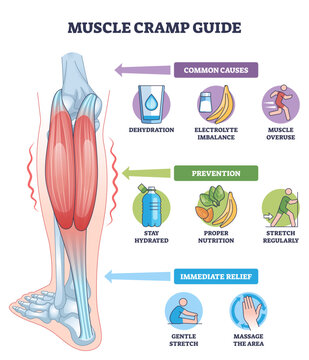 Muscle cramp guide diagram shows calf muscle, water bottle, and stretch icon, conveying causes, prevention, and relief tips for leg spasms, transparent background