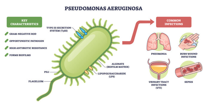 Pseudomonas aeruginosa brief diagram explains this gram negative pathogen and its diseases, focusing on bacterium cell, flagellum, and pili for quick study, transparent background