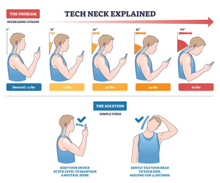 Tech neck explained visual shows head tilt angles raising cervical load while using a smartphone, highlights phone, spine, and posture correction steps, transparent background